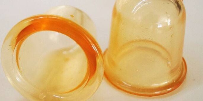 Tassen zur Behandlung von Prostatitis